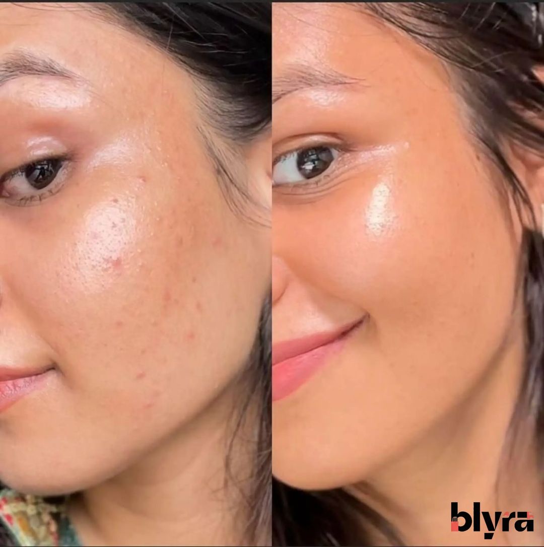 Set Facial Vitamina C Disaar 5 Piezas