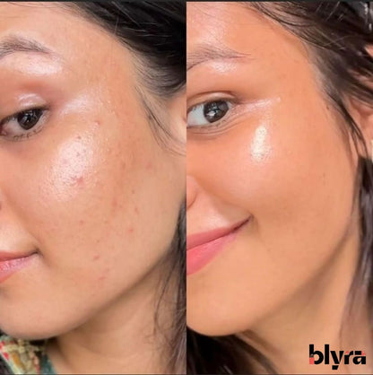 Set Facial Vitamina C Disaar 5 Piezas